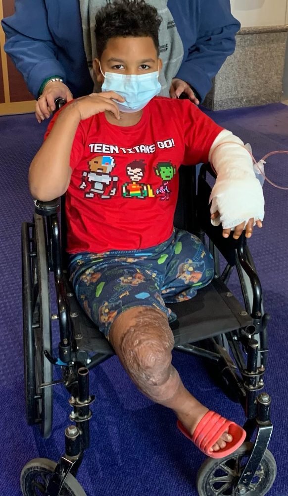 A brave boy in a wheelchair during his recovery